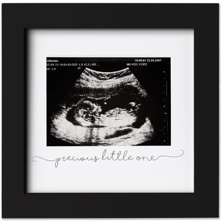 KeaBabies SOLO Baby Sonogram Picture Black Frame