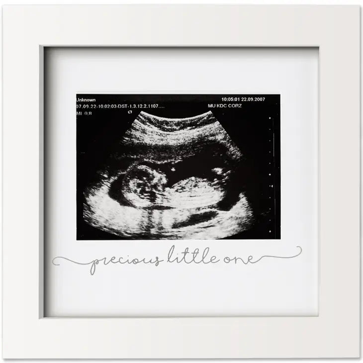 KeaBabies SOLO Baby Sonogram Picture Frame